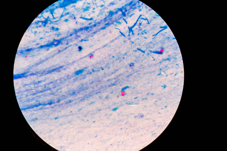 Cryptosporidium Drinking Pool Water