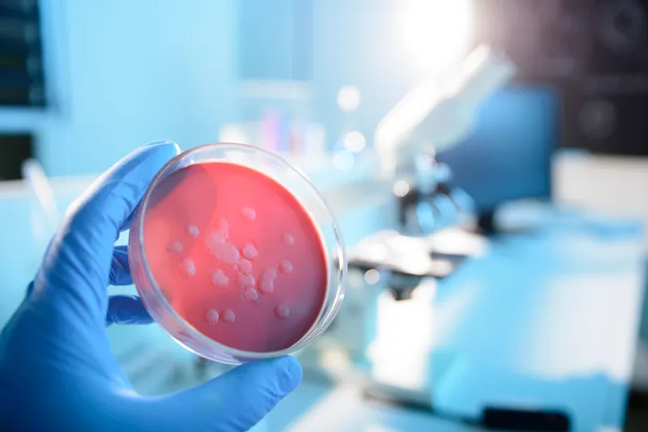 Microbiological culture in biosafety level 3 lab, BSL-3, designed with ANSI/ASSP Z9.14-2020
