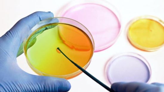 Scientist inspecting bright colorful Enterobacteriaceae to detect bacteria in the food chain via ISO 21528-2.