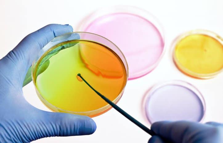 Enterobacteriaceae is tested Scientist inspecting bright colorful Enterobacteriaceae to detect bacteria in the food chain via ISO 21528-2.